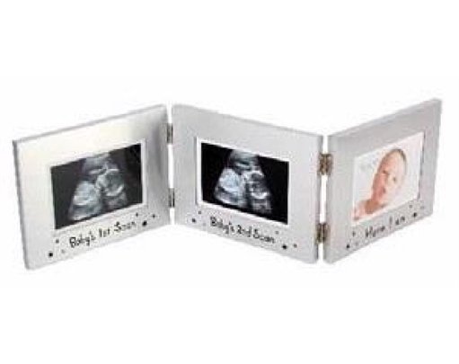 TRIPLE FRAME 1ST SCAN/2ND SCAN/HERE I AM