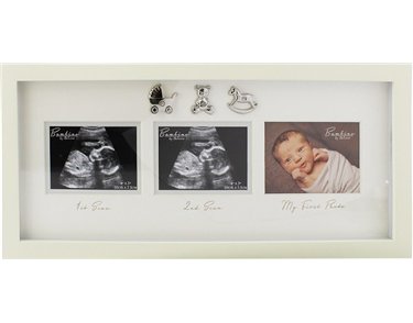 BAMBINO MDF SCAN FRAME