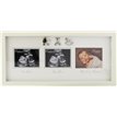 BAMBINO MDF SCAN FRAME